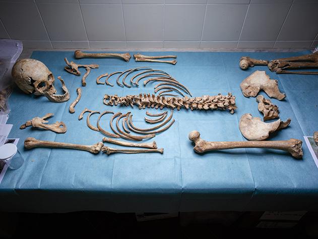 Italian-Renaissance-female-skeleton-1