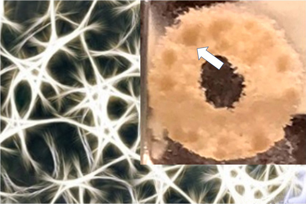 Brain tumor cells grow on 3D silk fiber/ECM matrix