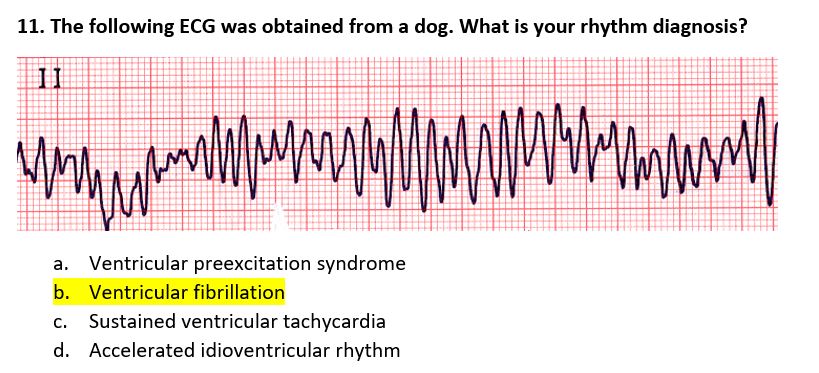 ventricular paced rhythm with failure to capture