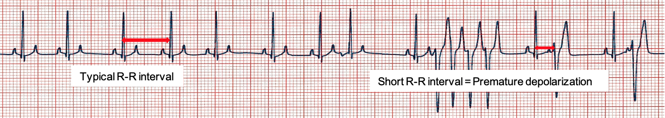 Electrocardiography I - CardioRush