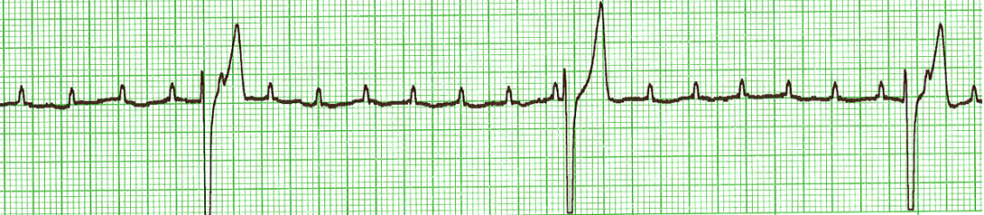 Electrocardiography I - CardioRush