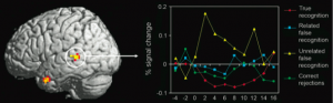 Figure 2: Increased activation of the left superior temporal gyrus during unrelated false recognition as compared to true recognition and related false recognition. (credit: Garoff-Eaton et al., 2006)