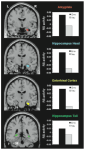 Neural Activation During Emotional Memory Retrieval   Credit: Dolcos et al. (2004)