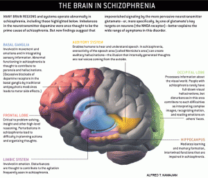 Alfred Kamajian- Image of A Schizophrenic Brain. http://schizophrenia.com/schizpictures.html#