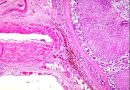 Adrenal gland of the horse adjacent to the vena cava