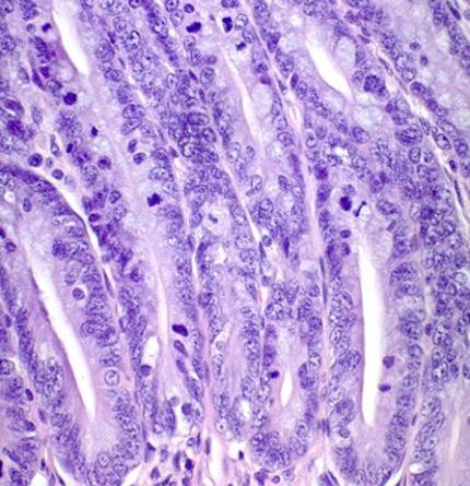 Mitosis in the Bottom of Intestinal Crypts – Collection of Histology Images