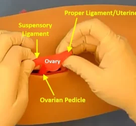 A close up view of the top of a low-fidelity spay simulator. An incision is made in the silicone skin and one uterine horn has been exteriorized and is being held in the surgeon's hands.